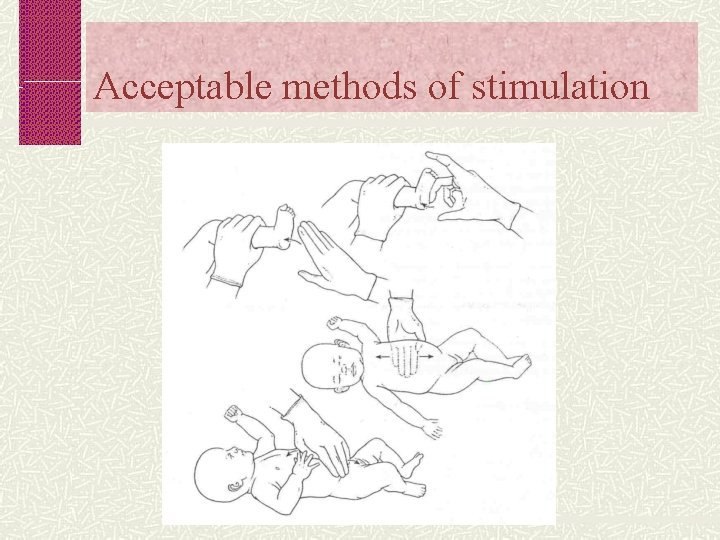 Acceptable methods of stimulation 