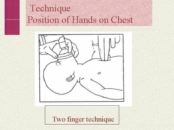 Technique Position of Hands on Chest Two finger technique 