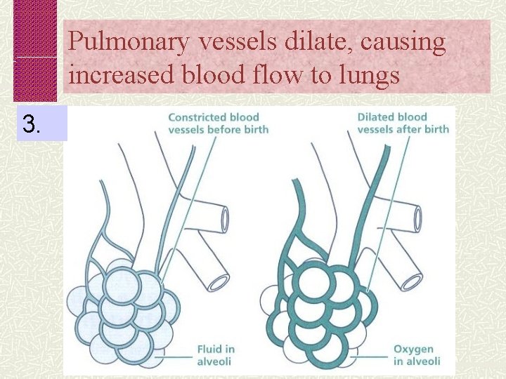 Pulmonary vessels dilate, causing increased blood flow to lungs 3. 