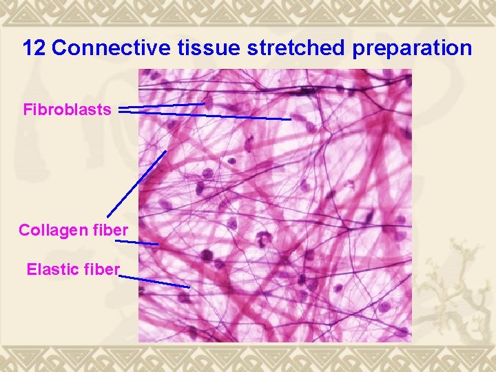 12 Connective tissue stretched preparation Fibroblasts Collagen fiber Elastic fiber 