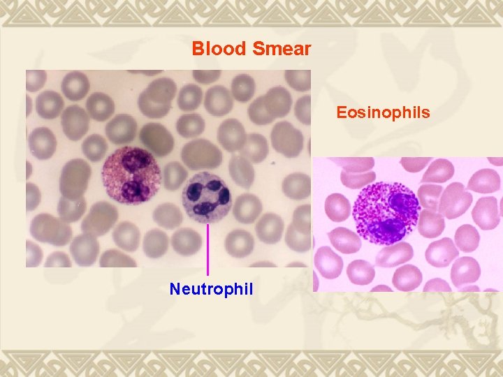 Blood Smear Eosinophils Neutrophil 