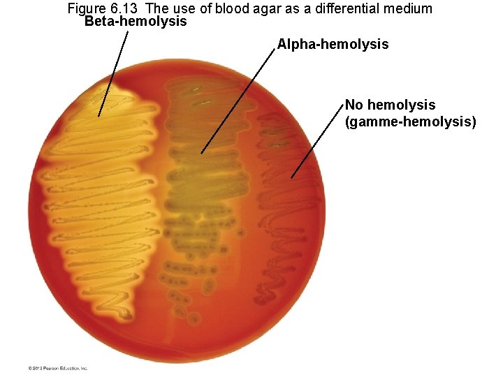 Figure 6. 13 The use of blood agar as a differential medium Beta-hemolysis Alpha-hemolysis