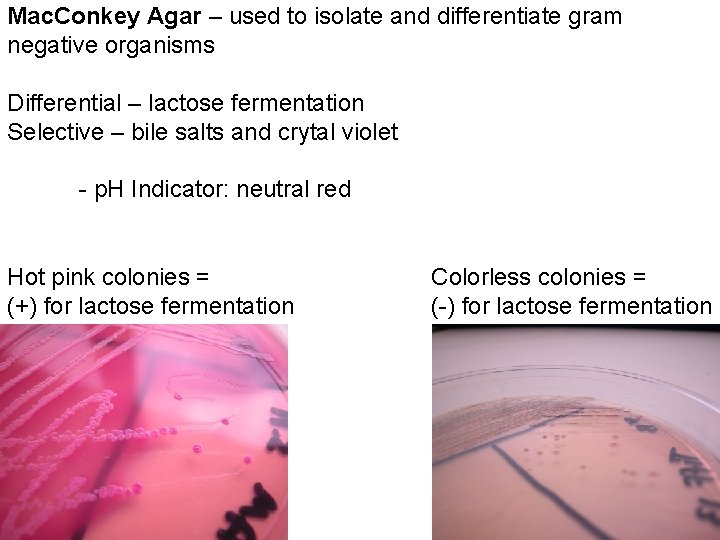Mac. Conkey Agar – used to isolate and differentiate gram negative organisms Differential –