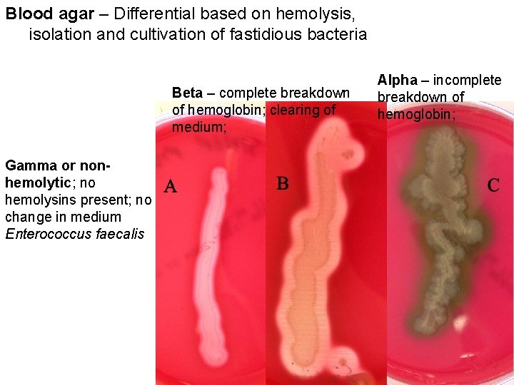 Blood agar – Differential based on hemolysis, isolation and cultivation of fastidious bacteria Beta