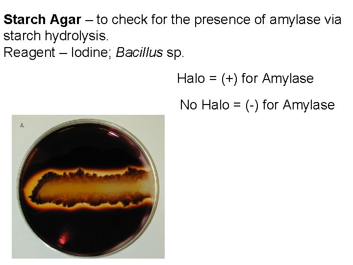 Starch Agar – to check for the presence of amylase via starch hydrolysis. Reagent