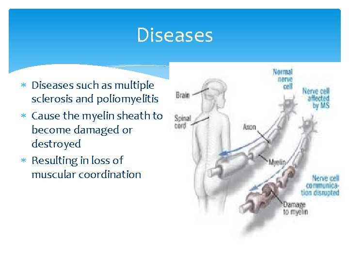 Diseases such as multiple sclerosis and poliomyelitis Cause the myelin sheath to become damaged