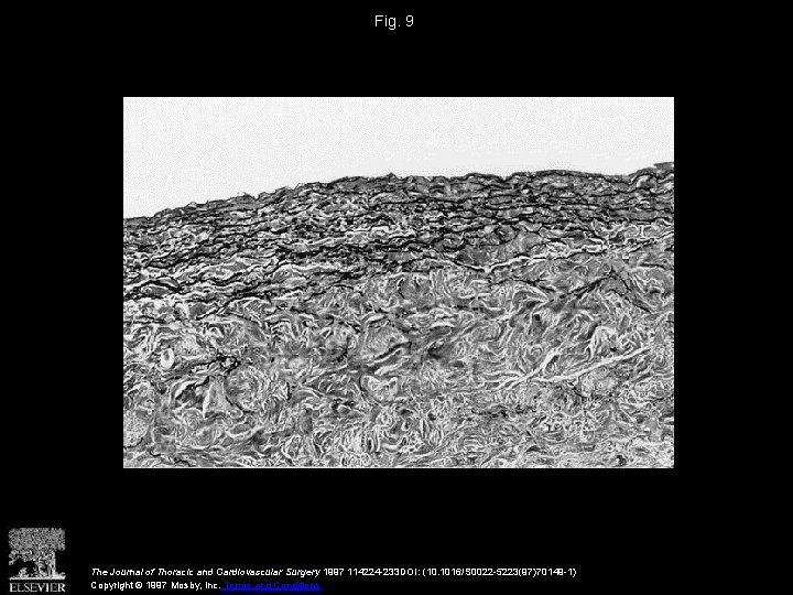 Fig. 9 The Journal of Thoracic and Cardiovascular Surgery 1997 114224 -233 DOI: (10.