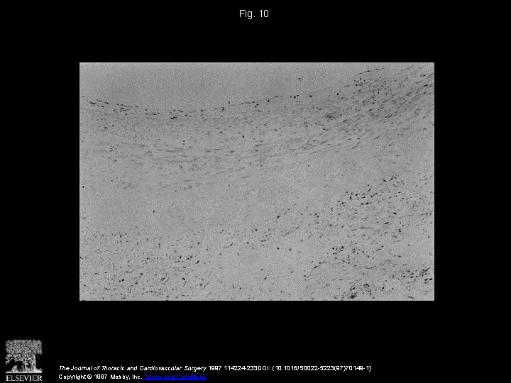 Fig. 10 The Journal of Thoracic and Cardiovascular Surgery 1997 114224 -233 DOI: (10.