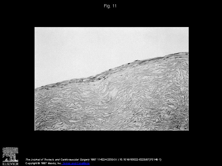 Fig. 11 The Journal of Thoracic and Cardiovascular Surgery 1997 114224 -233 DOI: (10.