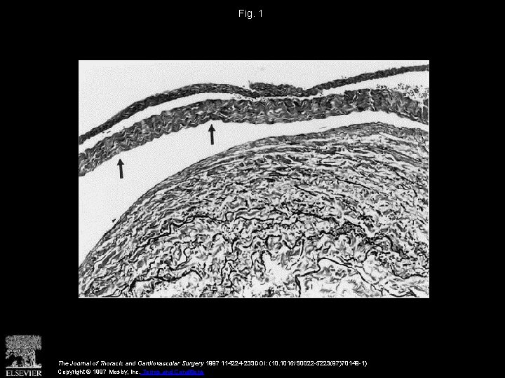 Fig. 1 The Journal of Thoracic and Cardiovascular Surgery 1997 114224 -233 DOI: (10.