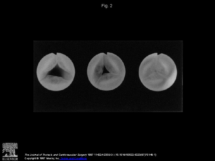 Fig. 2 The Journal of Thoracic and Cardiovascular Surgery 1997 114224 -233 DOI: (10.