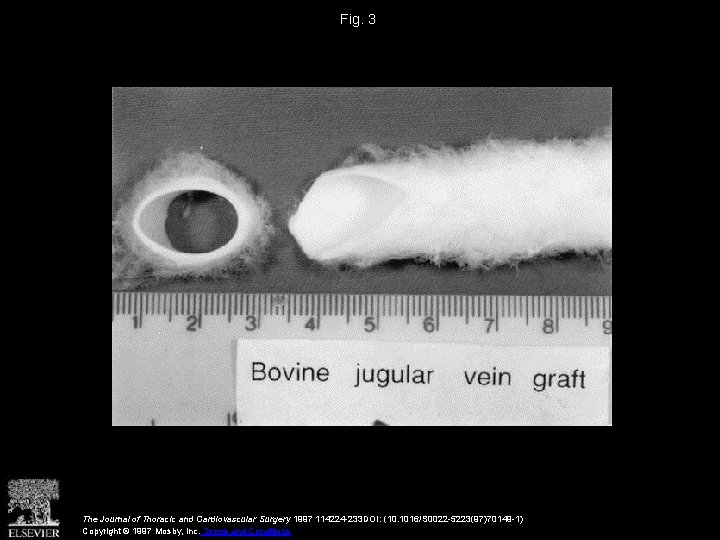 Fig. 3 The Journal of Thoracic and Cardiovascular Surgery 1997 114224 -233 DOI: (10.