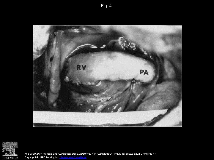 Fig. 4 The Journal of Thoracic and Cardiovascular Surgery 1997 114224 -233 DOI: (10.