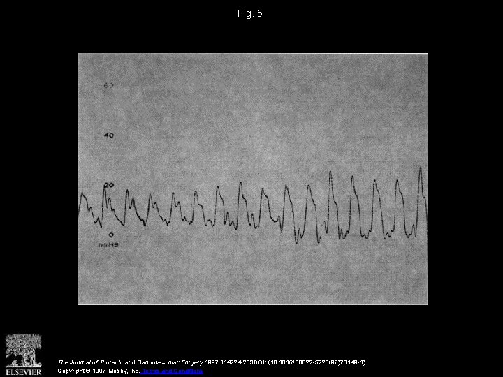 Fig. 5 The Journal of Thoracic and Cardiovascular Surgery 1997 114224 -233 DOI: (10.