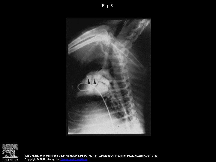 Fig. 6 The Journal of Thoracic and Cardiovascular Surgery 1997 114224 -233 DOI: (10.