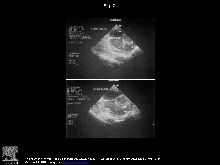 Fig. 7 The Journal of Thoracic and Cardiovascular Surgery 1997 114224 -233 DOI: (10.