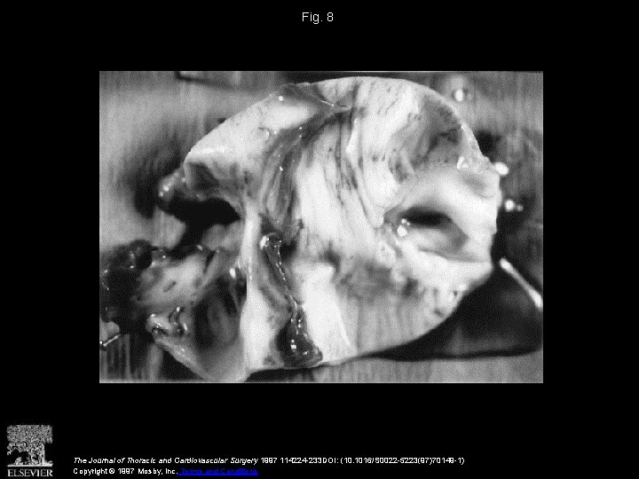 Fig. 8 The Journal of Thoracic and Cardiovascular Surgery 1997 114224 -233 DOI: (10.