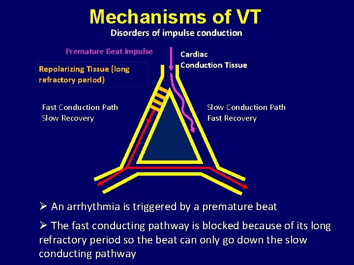 Mechanisms of VT Disorders of impulse conduction Premature Beat Impulse Repolarizing Tissue (long refractory