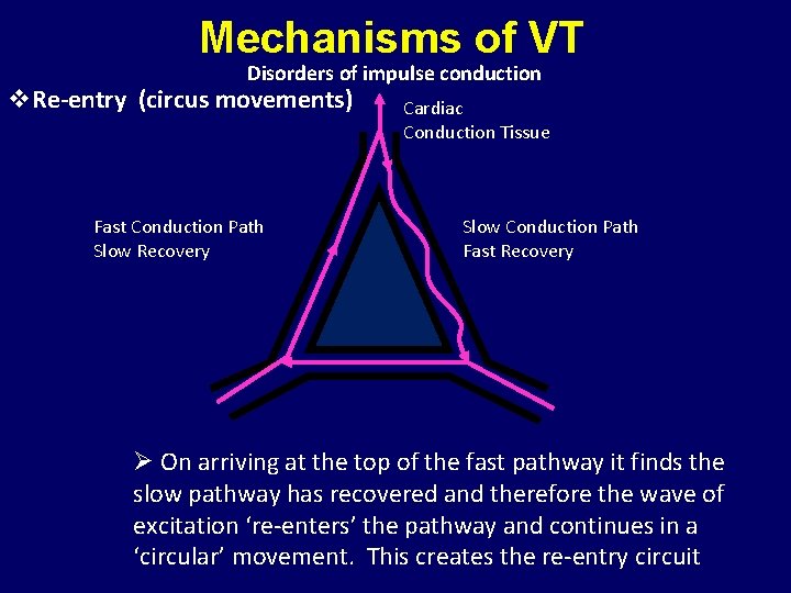 Mechanisms of VT Disorders of impulse conduction v. Re-entry (circus movements) Fast Conduction Path