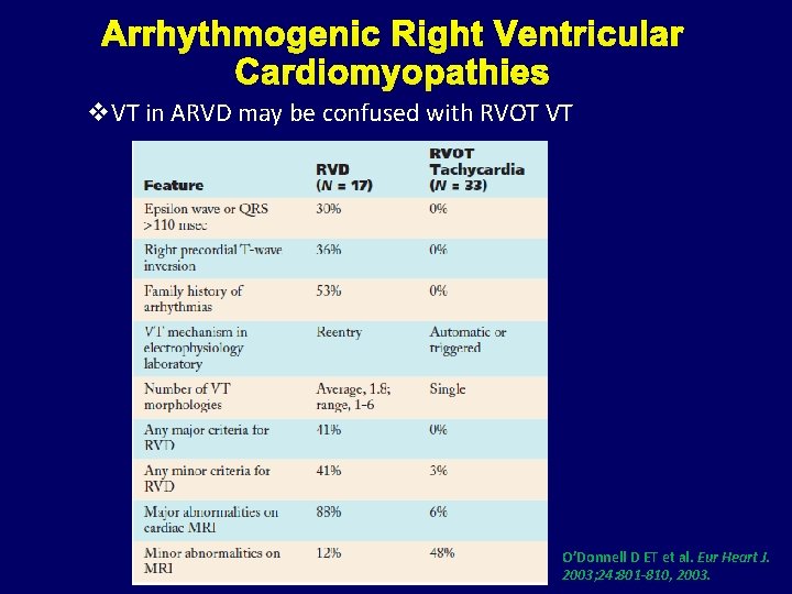 Arrhythmogenic Right Ventricular Cardiomyopathies v. VT in ARVD may be confused with RVOT VT