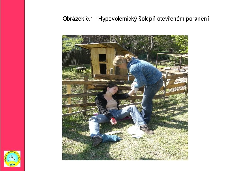 Obrázek č. 1 : Hypovolemický šok při otevřeném poranění 