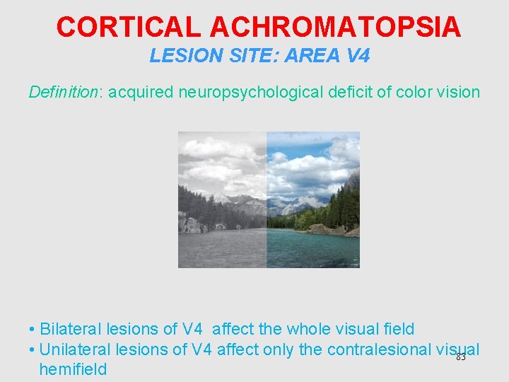 CORTICAL ACHROMATOPSIA LESION SITE: AREA V 4 Definition: acquired neuropsychological deficit of color vision