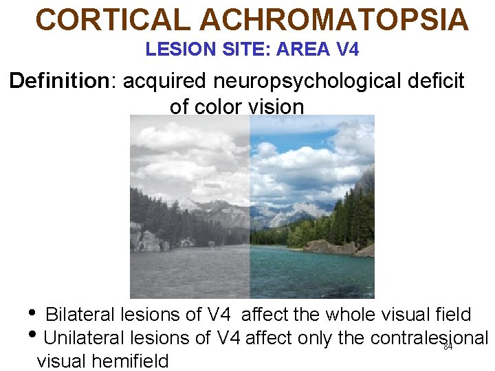 CORTICAL ACHROMATOPSIA LESION SITE: AREA V 4 Definition: acquired neuropsychological deficit of color vision
