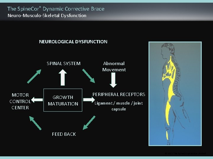 The Spine. Cor® Dynamic Corrective Brace Neuro-Musculo-Skeletal Dysfunction NEUROLOGICAL DYSFUNCTION SPINAL SYSTEM MOTOR CONTROL