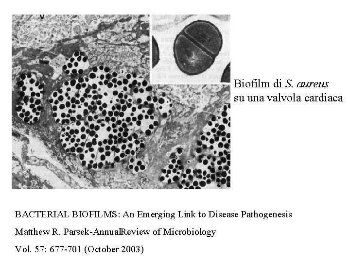 Biofilm di S. aureus su una valvola cardiaca BACTERIAL BIOFILMS: An Emerging Link to