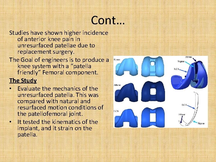 Cont… Studies have shown higher incidence of anterior knee pain in unresurfaced patellae due