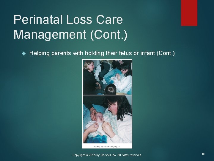 Perinatal Loss Care Management (Cont. ) Helping parents with holding their fetus or infant