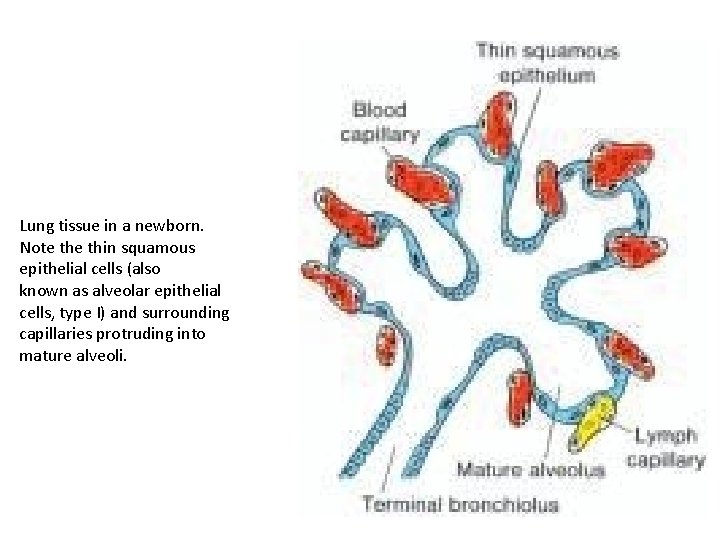 Lung tissue in a newborn. Note thin squamous epithelial cells (also known as alveolar