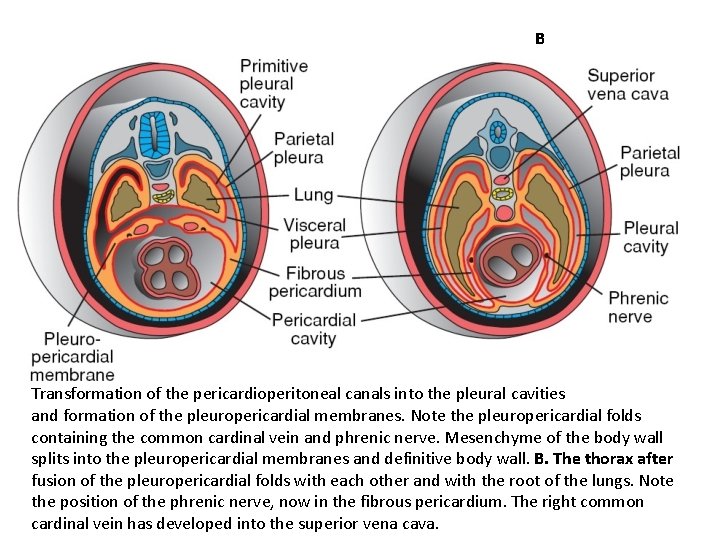 B Transformation of the pericardioperitoneal canals into the pleural cavities and formation of the
