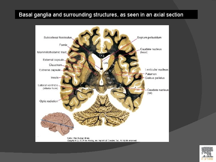 Basal ganglia and surrounding structures, as seen in an axial section 