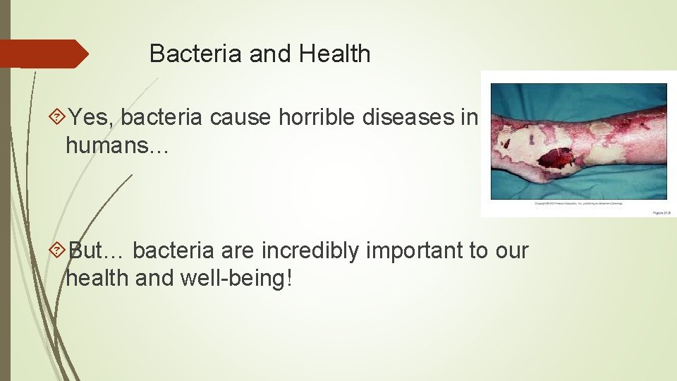 Bacteria and Health Yes, bacteria cause horrible diseases in humans… But… bacteria are incredibly