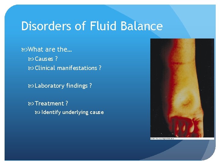 Disorders of Fluid Balance What are the… Causes ? Clinical manifestations ? Laboratory findings