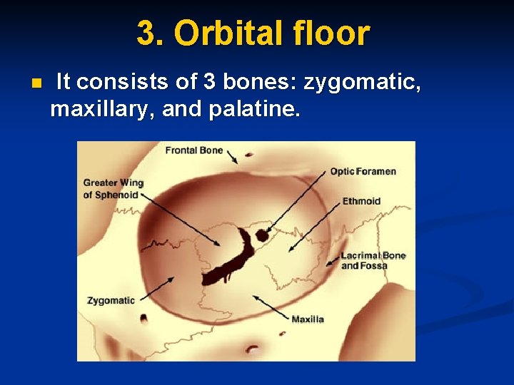 3. Orbital floor n It consists of 3 bones: zygomatic, maxillary, and palatine. 