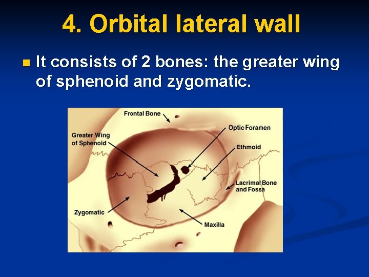 4. Orbital lateral wall n It consists of 2 bones: the greater wing of