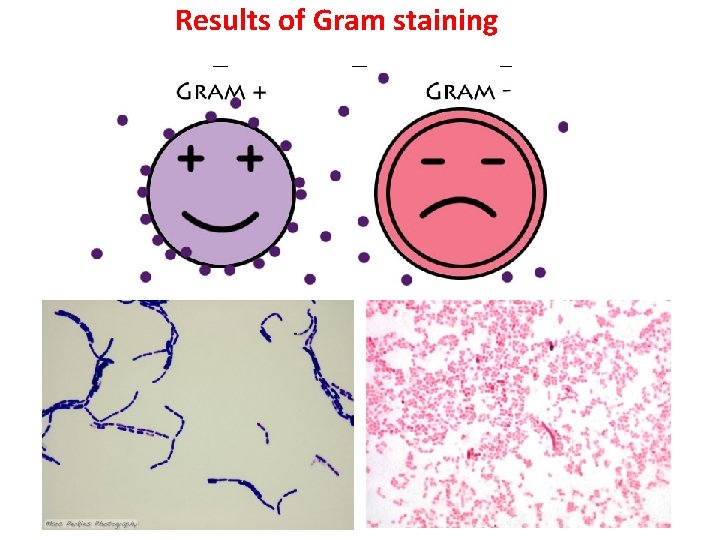 Results of Gram staining 