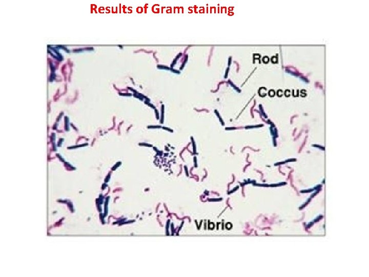 Results of Gram staining 