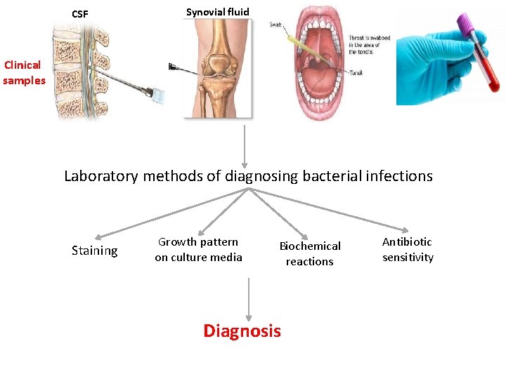 CSF Synovial fluid Clinical samples Laboratory methods of diagnosing bacterial infections Staining Growth pattern