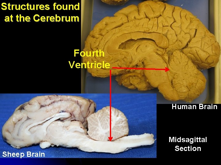 Structures found at the Cerebrum Fourth Ventricle Human Brain Sheep Brain Midsagittal Section 