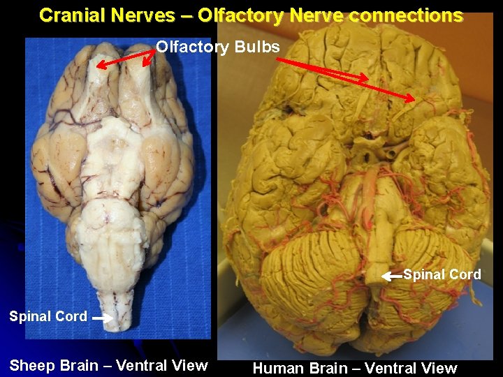 Cranial Nerves – Olfactory Nerve connections Olfactory Bulbs Spinal Cord Sheep Brain – Ventral