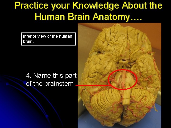 Practice your Knowledge About the Human Brain Anatomy…. Inferior view of the human brain.