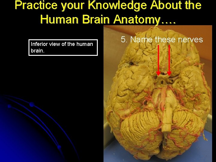 Practice your Knowledge About the Human Brain Anatomy…. Inferior view of the human brain.