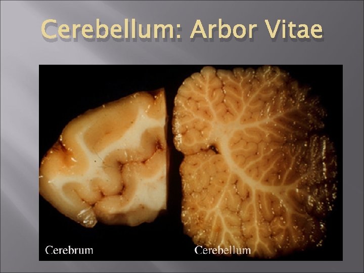 Cerebellum: Arbor Vitae Cerebellum: Arbor Vitae