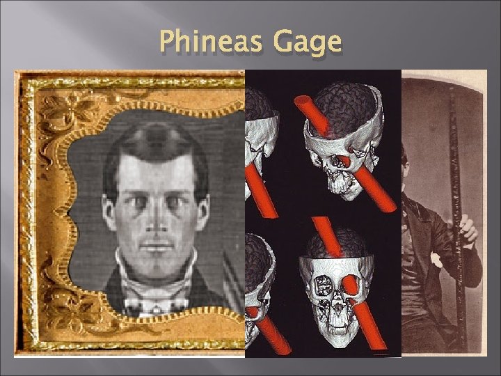 Phineas Gage Phineas Gage