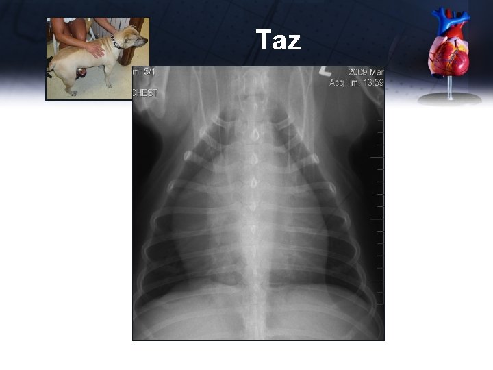 Taz 