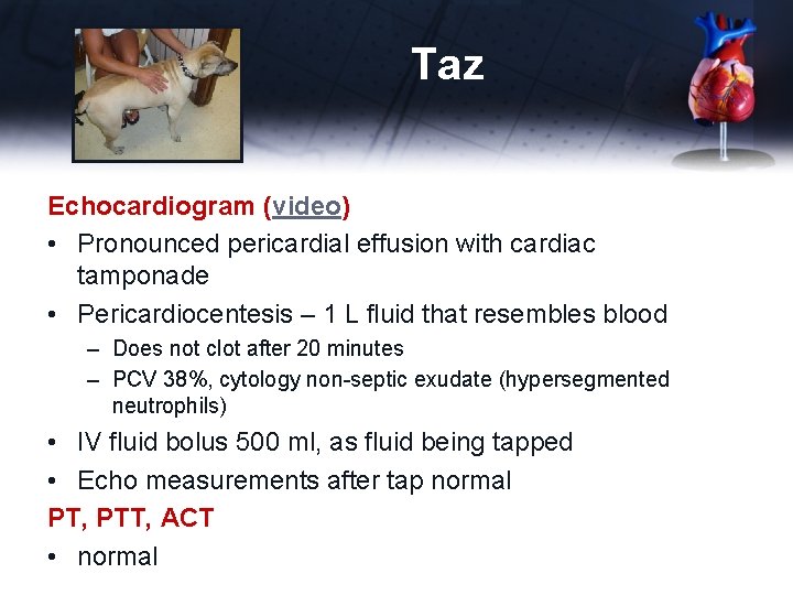 Taz Echocardiogram (video) • Pronounced pericardial effusion with cardiac tamponade • Pericardiocentesis – 1