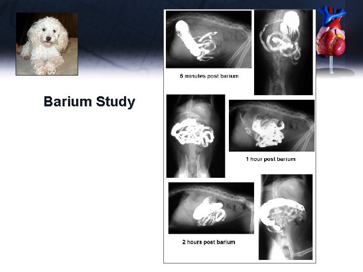 Waddles Barium Study 